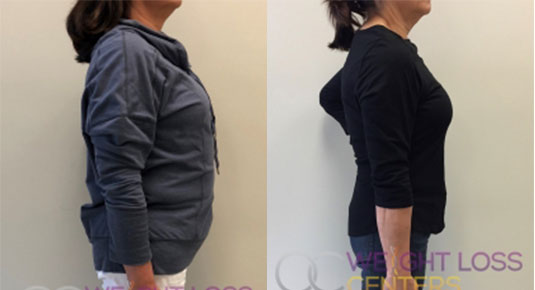 Weight loss program results