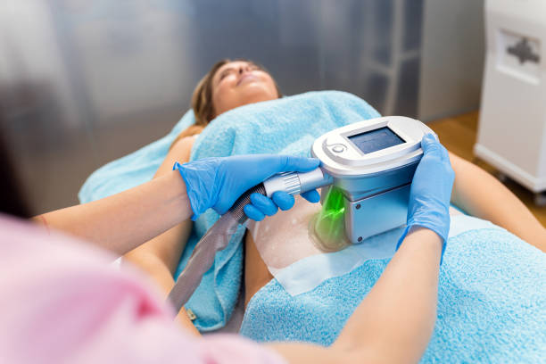 CoolSculpting applicator treatment