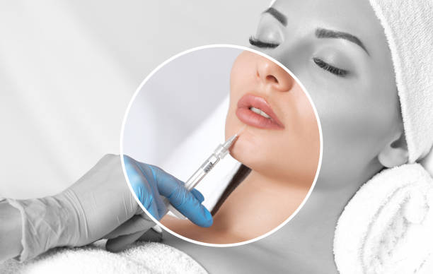 Juvederm dermal filler, ordered on request at OC Weight Loss and Med Spa