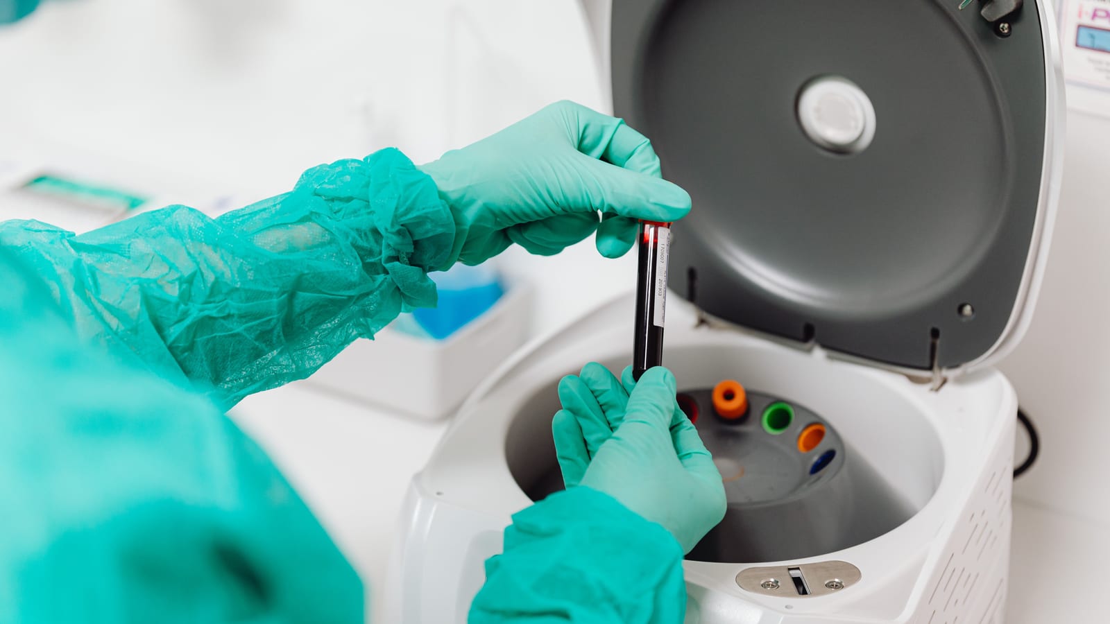 A clinician loading blood tubes into a centrifuge to prepare platelet-rich plasma in Mission Viejo